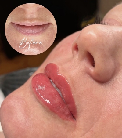 lip blush before and after